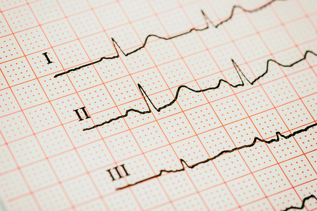 Private Medicals Newark